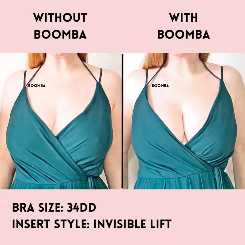 Invisible Lift Inserts - Image 20
