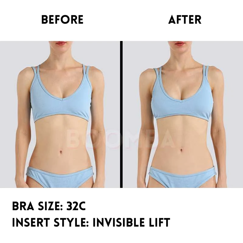 Invisible Lift Inserts - Image 7